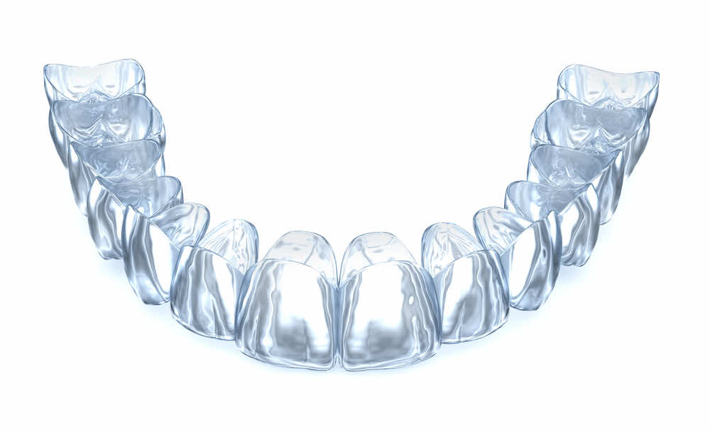 clear-aligners-close-up