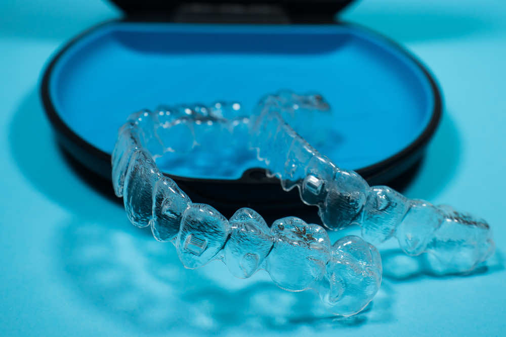 clear-aligners-in-container