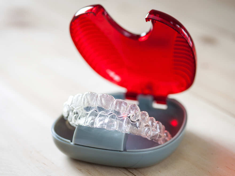 invisible-aligner-in-a-red-container